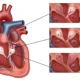 kalp-kapak-hastaliklari_rehber